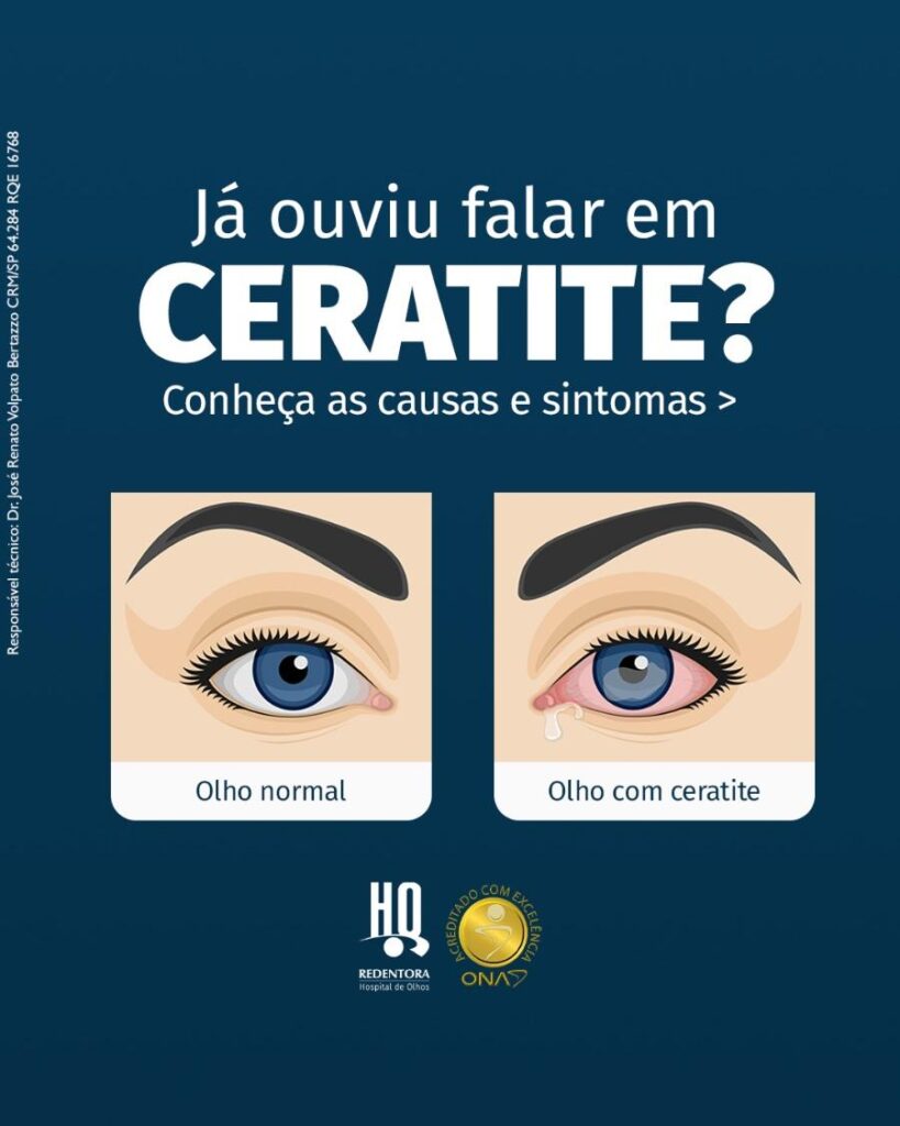 Hordéolo: causas, sintomas e tratamentos - Clínica de Olhos